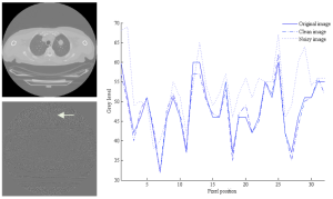 Tumor texture analysis - CT noise