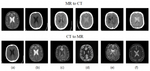 MR-to-CT & CT-to-MR