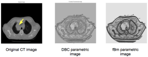 Tumor texture analysis - Fractal parametric images