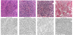 Tumor texture analysis - histology texture analysis