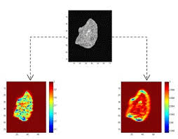 RF Ultrasound fractal maps